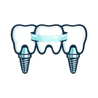 Icon of an implant-supported dental bridge