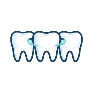 Icon of a Maryland resin-bonded dental bridge