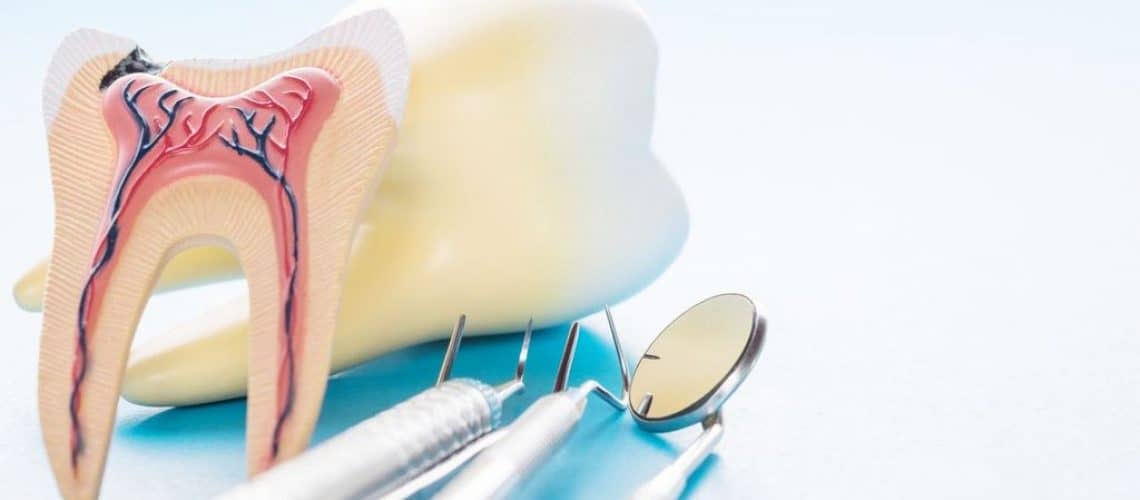 4-things A model of a tooth showing internal structure is placed next to dental tools, including a mirror and probes, on a light blue background, perfect for illustrating dental care in Grande Prairie.