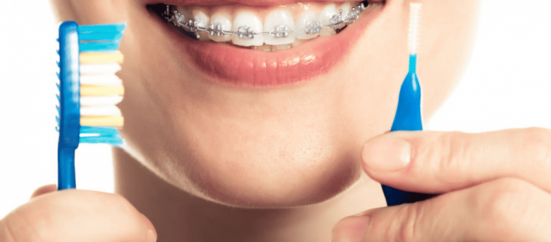 A person with braces holds a toothbrush in one hand and an interdental brush in the other, smiling and showing their teeth after visiting dental Grande Prairie.