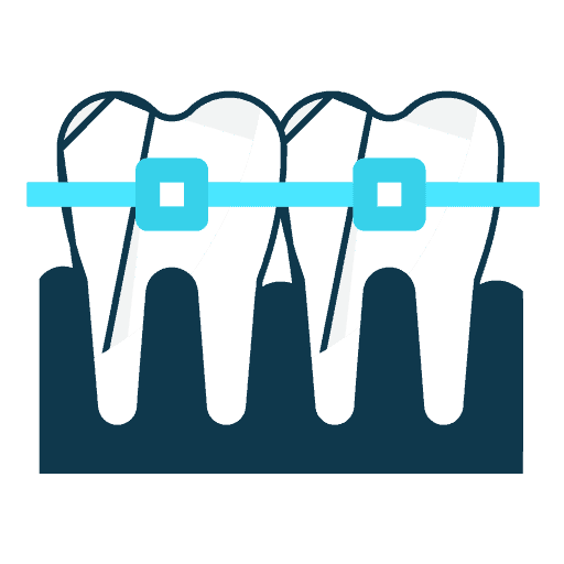 Illustration of two teeth with braces attached, connected by a wire, against a dark background—perfect for showcasing orthodontic care at dental Grande Prairie clinics.