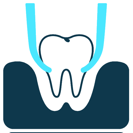 Illustration of a tooth being extracted from the gum using dental forceps, as seen in procedures at dental Grande Prairie clinics.