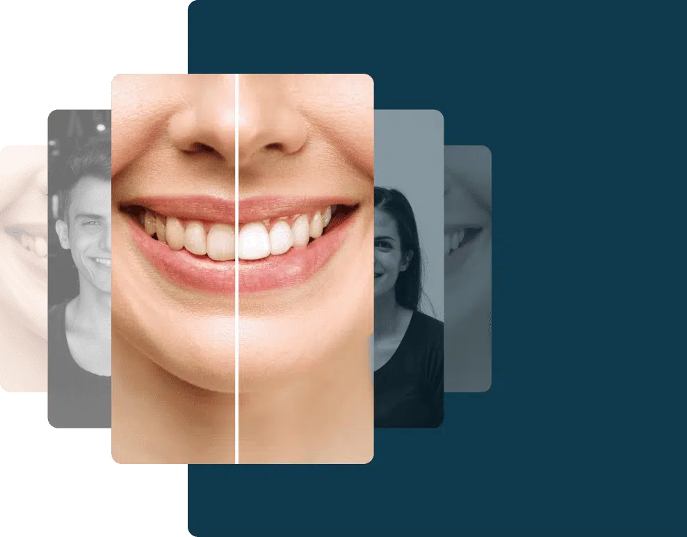 A collage of overlapping photos showing close-ups of smiling people, with the central image featuring a split-screen of teeth before and after whitening at a dental Grande Prairie clinic.