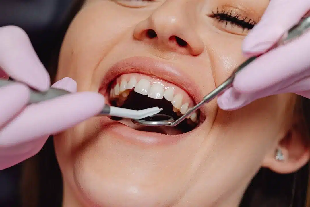 dental-cleaning-featured-image A person at a dental check-up with mouth open, while a dentist wearing pink gloves uses dental tools to examine their teeth at a dental clinic in Grande Prairie.