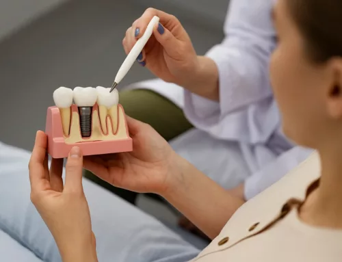 What the Research Shows About Dental Implant Success Rates
