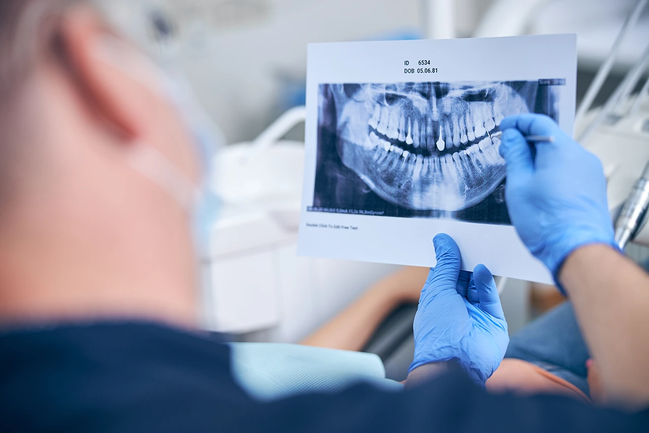 A dentist wearing gloves holds and examines a dental X-ray image, showing the teeth and jaw of a patient in a dental clinic.