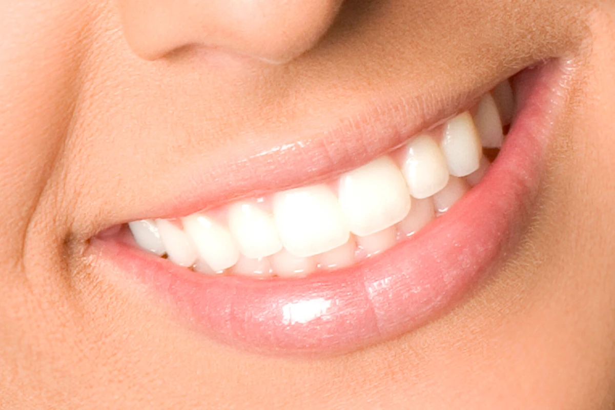 Close-up of a person’s mouth showing clean, white teeth and smooth lips, with a natural smile.