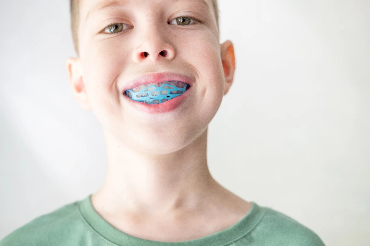Boy in a green shirt smiling, showing a blue mouthguard with a pattern over his teeth.